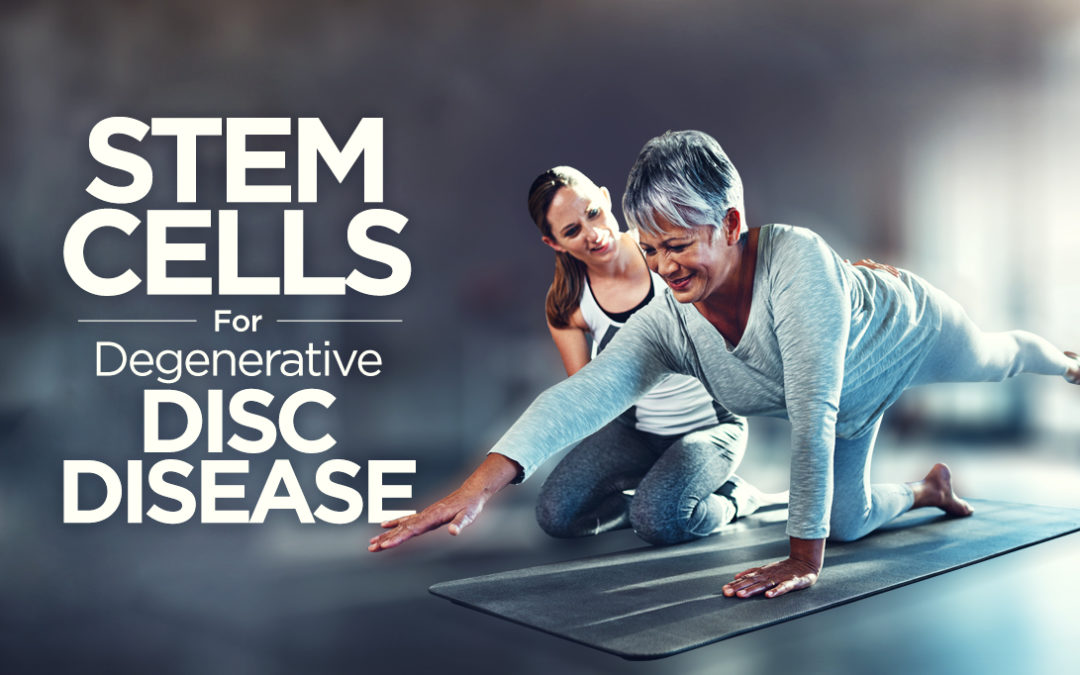 Stem cells for degenerative disc disease