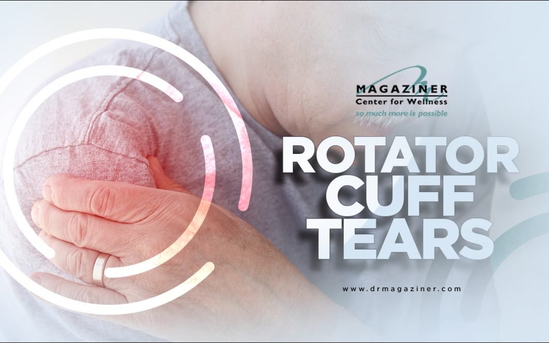 Rotator Cuff Tears